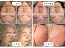 バーガルサロンギンザ(VAGAL SALON GINZA)の雰囲気(結果重視の施術で1回でもしっかりと効果を実感いただけます。)