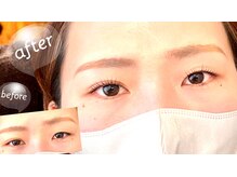 ベロニカ(Beronica)/左右差なくぱっちり