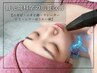 【ニキビ／毛穴／リフトアップ】小顔×肌管理が叶うサーマニードル ¥12,000