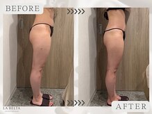 エステティックサロン ラ ベルタ(Esthetic Salon La Belta)/セルライトゼロ