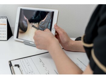 ミース 宮崎店/うなじ脱毛の詳細カウンセリング