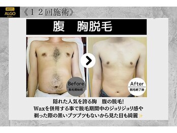 アルゴ 南茨木駅前店(ALGO)/【メンズお腹】