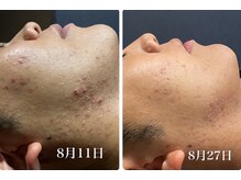ゴールドプラス 伊勢店(GOLD PLUS)/BeforeAfter
