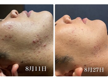ゴールドプラス 伊勢店(GOLD PLUS)/BeforeAfter