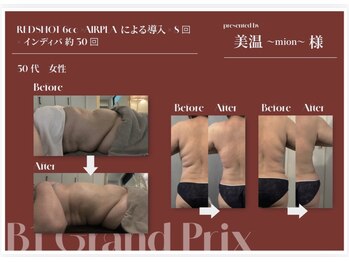 美温(mion)の写真/体重よりも見た目で変わる！脂肪分解REDSHOTコンテスト入賞の実力派サロン☆