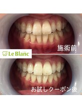 ルブラン 奈良店(Le Blanc)/今年で8周年！！