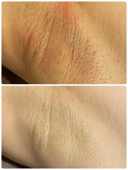 アネル 豊見城(anel)/