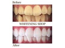ホワイトニングショップ 岩出店(WHITENINGSHOP)の雰囲気（全国展開のホワイトニング）
