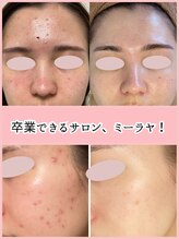 ミーラヤ(MILAYA) 健康美を 叶えます