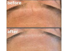 オンビューティーバイコンベックス(On Beauty by convex)/驚きのビフォーアフター