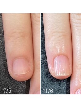ネイルズ アヴァンティ(Nails Avanti)/自爪育成ネイルケア