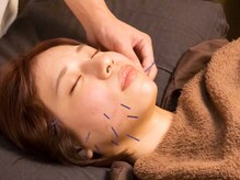 一樹鍼灸院の雰囲気（美容鍼はリフトアップやしみしわほうれい線の改善におすすめです）