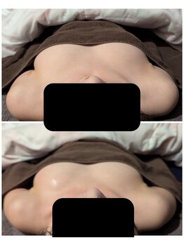 スノードロップ(snowdrop)/