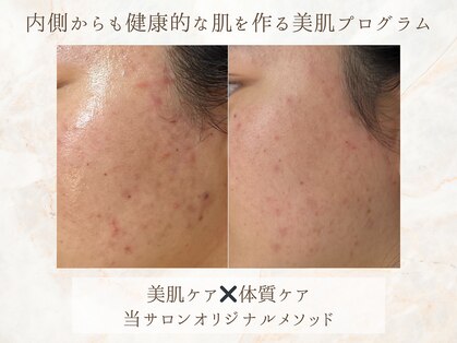 ミリアージュ(Miliage)の写真