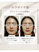 イチカ 仙川店( ichika)/右側だけよく使う、左右差の改善