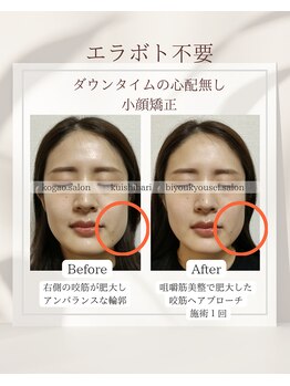 イチカ 仙川店( ichika)/右側だけよく使う、左右差の改善