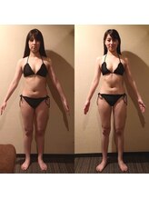 龍虎道鍼灸院/ダイエット鍼