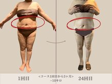 エル 麻布十番(LllL)/【痩身】3ヶ月で-10kg減量
