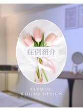 エレミュー(Elemue)/症例紹介