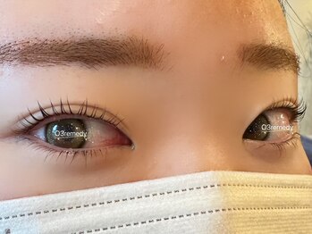 オゾンレメディ(O3remedy)/360°美しい上下まつ毛パーマ