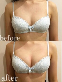 サロン ド メグリィ(Salon de meguli)/ふわふわバスト