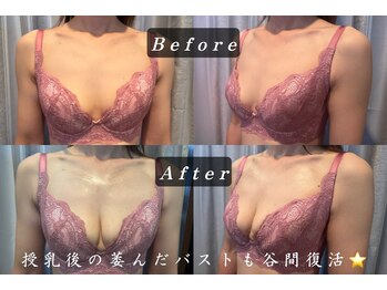 エステティックサロン パヒューム(Esthetic Salon Perfume)/〈 30代 3人授乳のお客様 〉