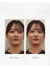 リファイン整体院 国分寺店/小顔、骨盤、ヘッドスパ、整体