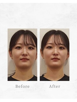 リファイン整体院 国分寺店/小顔、骨盤、ヘッドスパ、整体