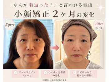 オム(Omu)の写真/むくみ・フェイスラインが気になる方へ♪すっきり小顔印象に