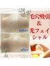 【夏の皮脂黒ずみをきれいに☆毛穴吸引＆光フェイシャル】8500円→5700円