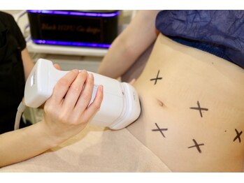 スキニー 六本木店(Skinnie)/ブラックスタンプお腹施術