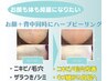 お顔とお背中同時にハーブピーリングでツルスベ肌へ¥30,800→¥22,000