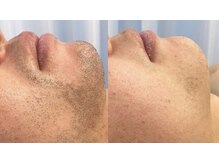 ラクーン(RACCOON)/