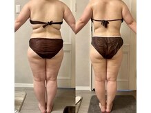 ヴィエーゾ(VIESO)/別人級！！