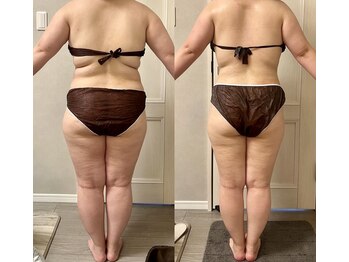 ヴィエーゾ(VIESO)/別人級！！