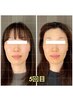 【最近疲れてる？って言わせない】小顔矯正&もみほぐし30分&ヘッドスパ20分