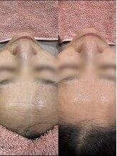 アース オーセンティック 新浦安店(EARTH Authentic)/【潤艶Wax×美容液導入】