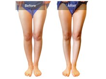 ベンザイ 梅田店(BENZAI)/部活で鍛えた、スキニーが似合う