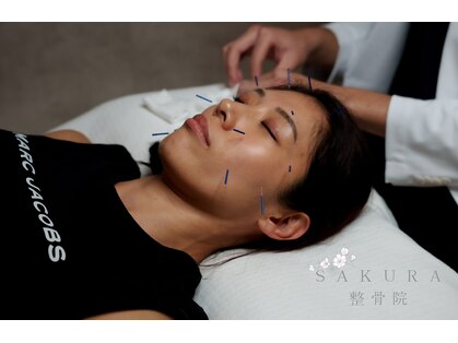 サクラ鍼灸整骨院 桜並木駅前(SAKURA鍼灸整骨院)の写真