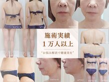 【痩身/ブライダル痩身/フェイシャルケア】熟練ケアで結果出し◎