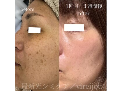 プライベートアイラッシュサロン ヴィレージュ 稲毛店(Vireijou)の写真