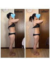 月ノユメ(tsukinoyume)/姿勢の崩れはぽっこりお腹を作る