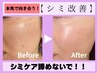 【シミ】本気のシミ改善¥7,400