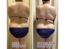 クールスパ(COOL SPA)/背中1回でスッキリ