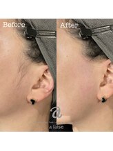 ア レーズ(a laise)/フェイシャルワックス☆