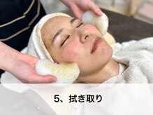 ラウレア(LAULEA)/5、拭き取り