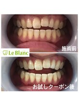 ルブラン 奈良店(Le Blanc)/男性の方女性のお口元！歯！