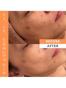 カオヤ プラス(Kaoya plus)/エンビロン無料カウンセリング◎