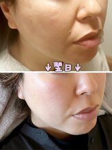 リムー(RE@Muu)/技術受けた翌日