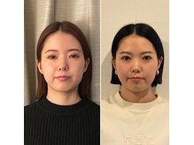 リアライン ラボの雰囲気(1ヶ月間で2回のむくみケア実施(マタニティ、産前産後、リンパ))